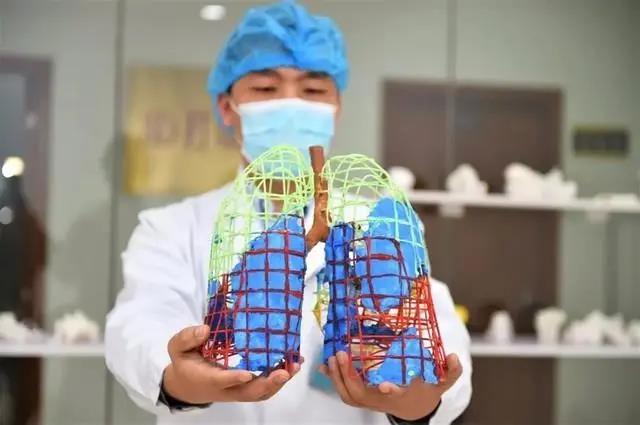 湖南3D打印新冠肺炎病灶模型 診療更有效！