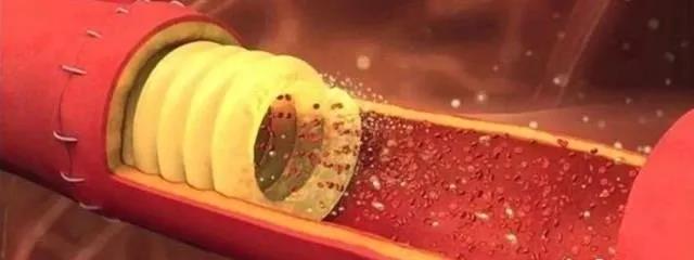 澳科研機(jī)構(gòu)研發(fā)出一種3D打印血管支架