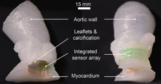 科學家3D打印出逼真的心臟瓣膜模型
