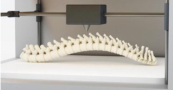 3D打印技術與醫療的碰撞 未來或為患者帶來更多福音