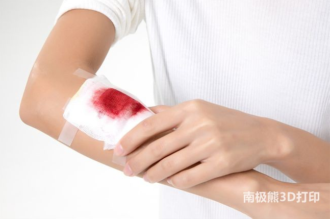 最新研究顯示3D打印血漿可加速傷口愈合