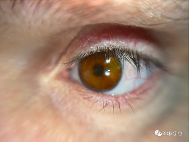 Fraunhofer正在徹底改變眼部假體的3D 打印